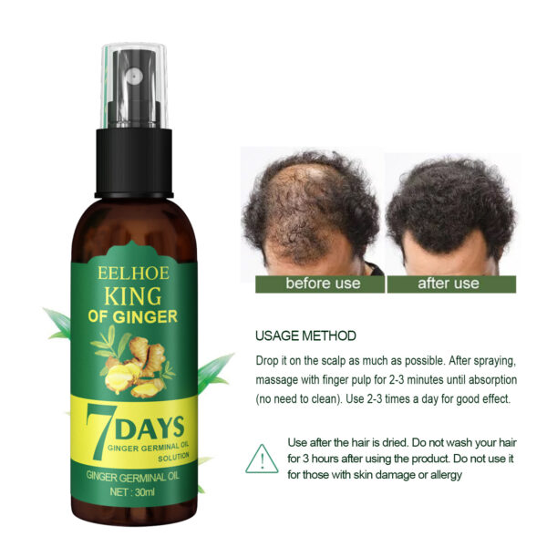 546519694 EEL Ginger Hair Spray, Strengthens Hair, Massages Scalp And Restores Hair